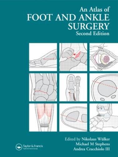 Atlas Foot and Ankle Surgery