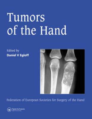 Tumors of the Hand: Published in association with the Federation of European Societies for Surgery of the Hand