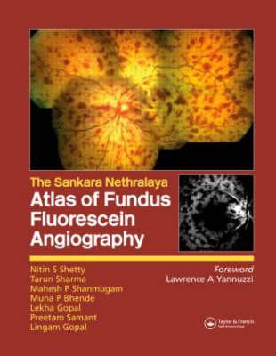 Atlas of Fundus Fluorescein Angiography