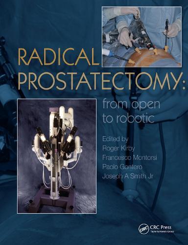 Radical Prostatectomy: From Open to Robotic