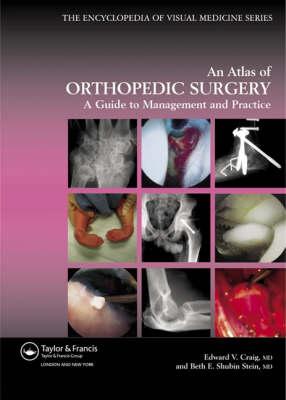 Atlas of Orthopedic Surgery: A Guide to Management and Practice