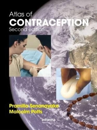 Atlas of Contraception