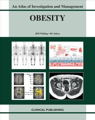 Obesity