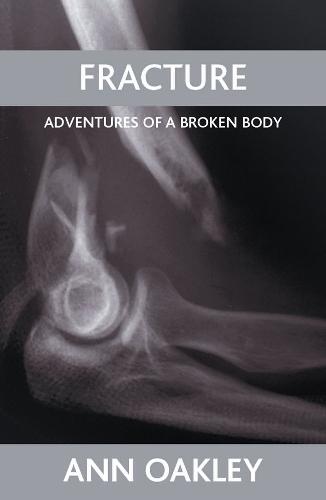 Fracture: Adventures of a broken body