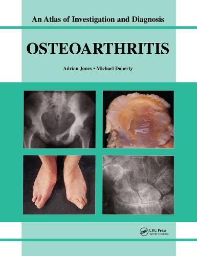 Oesteoarthritis: An Atlas of Investigation and Diagnosis