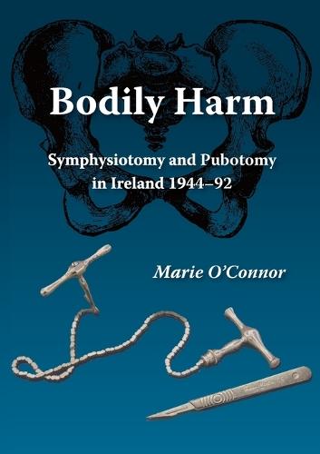 Bodily Harm: Symphysiotomy and Pubiotomy in Ireland 1944-92