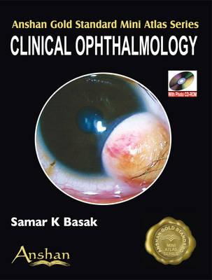 Mini Atlas of Clinical Ophthalmology