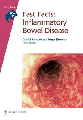 Fast Facts: Inflammatory Bowel Disease