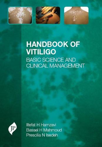 Handbook of Vitiligo: Basic Science and Clinical Management
