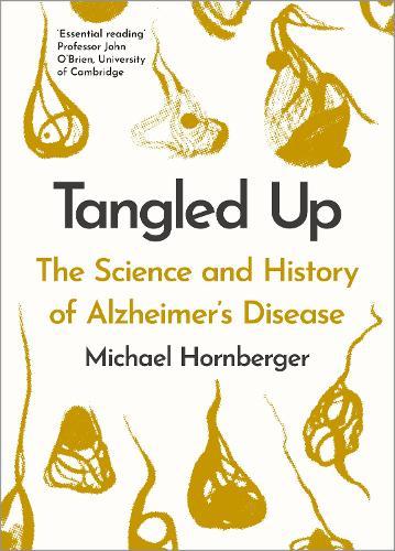 Tangled Up: The History and Science of Alzheimer's Disease