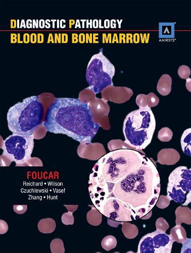 Diagnostic Pathology: Blood and Bone Marrow: Published by Amirsys (R)