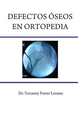 Defectos Oseos En Ortopedia