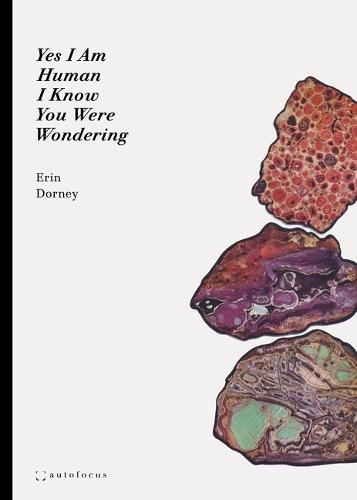 Yes I Am Human I Know You Were Wondering