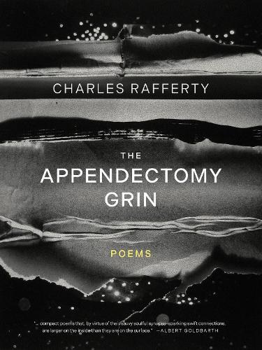 The Appendectomy Grin