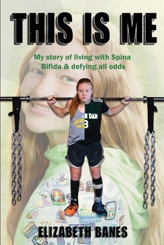 This Is Me: My story of living with Spina Bifida & defying all odds