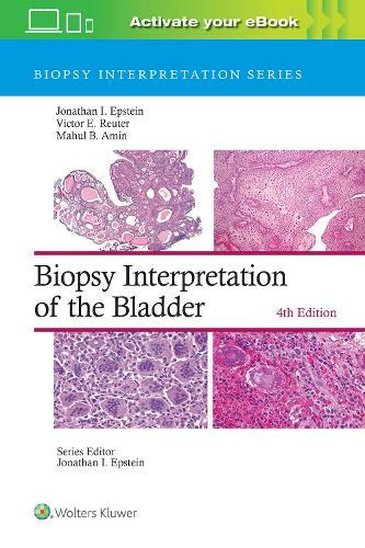 Biopsy Interpretation of the Bladder: Print + eBook with Multimedia