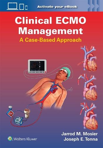 Clinical ECMO Management: A Case-Based Approach