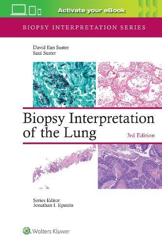 Biopsy Interpretation of the Lung: Print + ebook with Multimedia