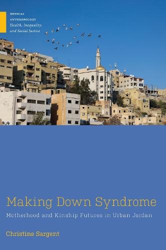 Making Down Syndrome: Motherhood and Kinship Futures in Urban Jordan