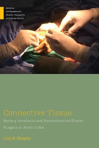 Connective Tissue: Factory Accidents and Reconstructive Plastic Surgery in South India
