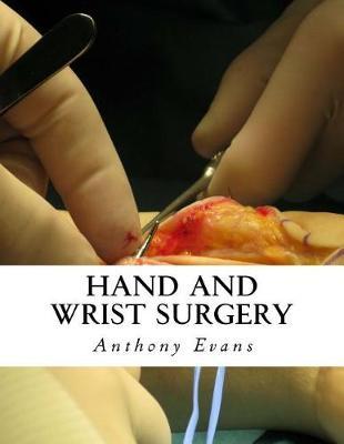 Hand and Wrist Surgery