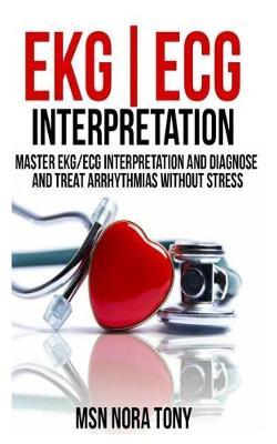 Ekg/ECG Interpretation: Master Ekg/ECG Interpretation and Diagnose and Treat Arrhythmias Without Stress