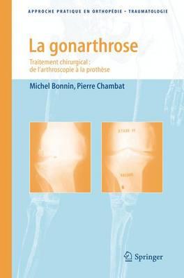Gonarthrose: Traitement Chirurgical - De L'Arthroscopie a LA Prothese