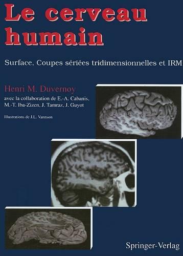 Le Cerveau Humain: Surface, Coupes Sériées Tridimensionnelles Et Irm