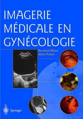 Imagerie Medicale En Gynecologie