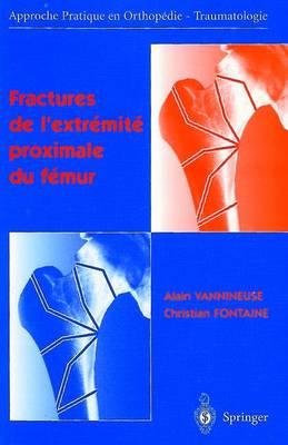 Fractures de l'Extrémité Proximale Du Fémur