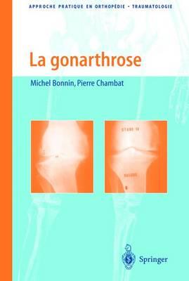 La Gonarthrose: Traitement Chirurgical: de Larthroscopie a la Prothese