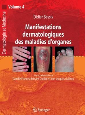 Manifestations Dermatologiques Des Maladies d'Organes: Dermatologie Et Médecine, Vol. 4