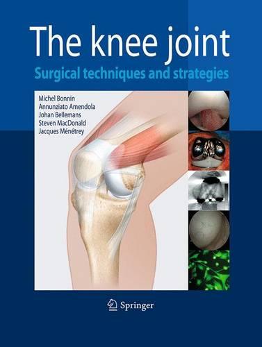 The Knee Joint: Surgical Techniques and Strategies