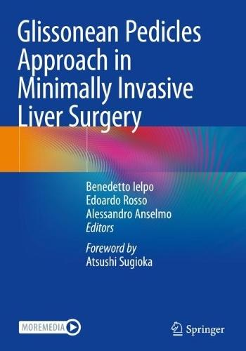 Glissonean Pedicles Approach in Minimally Invasive Liver Surgery