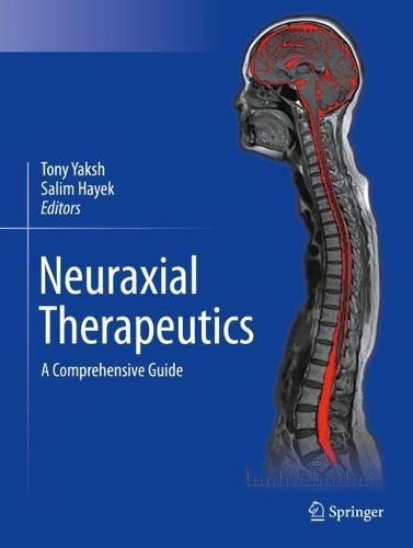 Neuraxial Therapeutics: A Comprehensive Guide
