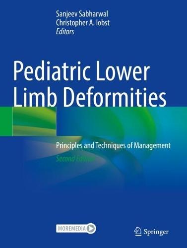 Pediatric Lower Limb Deformities: Principles and Techniques of Management