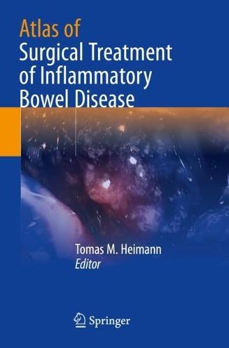 Atlas of Surgical Treatment of Inflammatory Bowel Disease