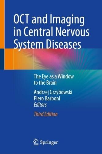 OCT and Imaging in Central Nervous System Diseases: The Eye as a Window to the Brain