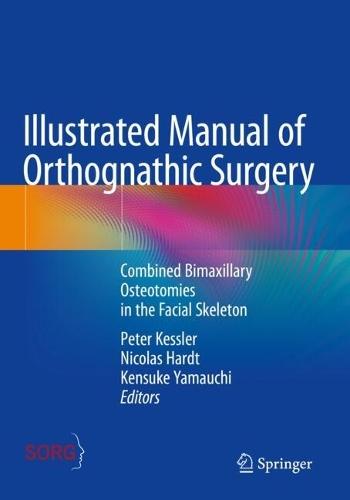 Illustrated Manual of Orthognathic Surgery: Combined Bimaxillary Osteotomies in the Facial Skeleton