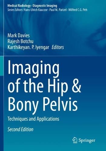 Imaging of the Hip & Bony Pelvis: Techniques and Applications