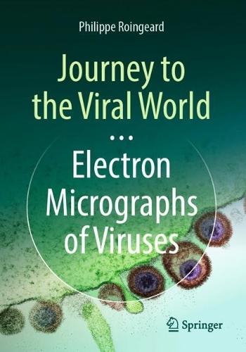Journey to the Viral World: Electron Micrographs of Viruses