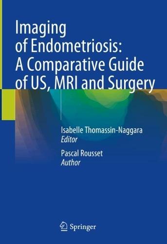 Imaging of Endometriosis: A Comparative Guide of US, MRI and Surgery