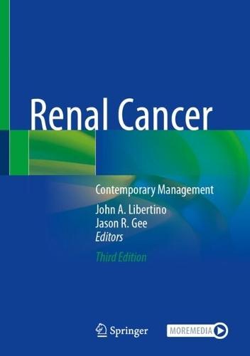 Renal Cancer: Contemporary Management