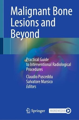 Malignant Bone Lesions and Beyond: Practical Guide to Interventional Radiological Procedures