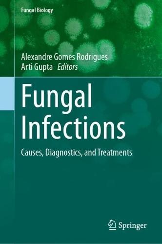 Fungal Infections: Causes, Diagnostics, and Treatments
