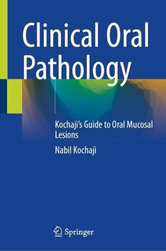 Clinical Oral Pathology: Kochaji's Guide to Oral Mucosal Lesions