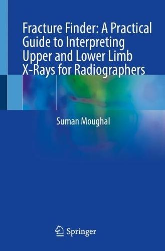 Fracture Finder: A Practical Guide to Interpreting Upper and Lower Limb X-Rays for Radiographers