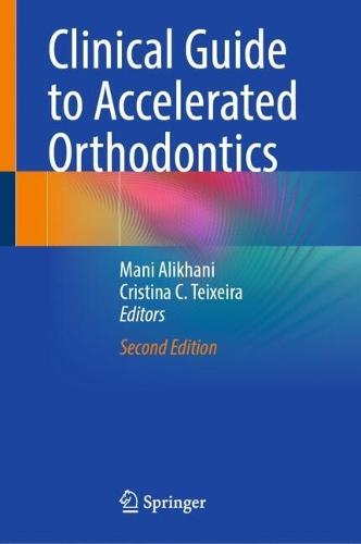 Clinical Guide to Accelerated Orthodontics