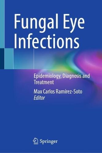 Fungal Eye Infections: Epidemiology, Diagnosis and Treatment