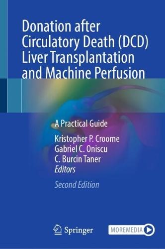 Donation after Circulatory Death (DCD) Liver Transplantation and Machine Perfusion: A Practical Guide